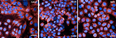 Development of a visual Adhesion/Invasion Inhibition Assay to assess the functionality of Shigella-specific antibodies